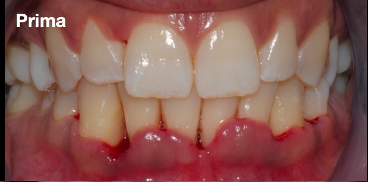 Prima del trattamento odontoiatrico